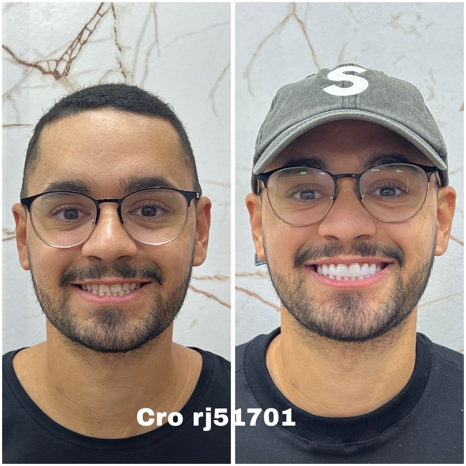 Antes e Depois - Transformação Homem